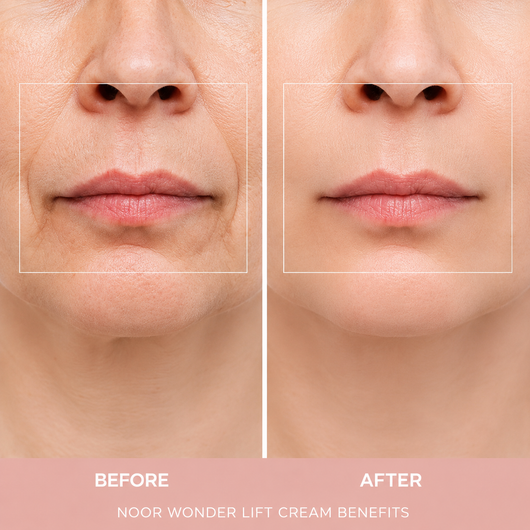NEXURA WonderLift Cream