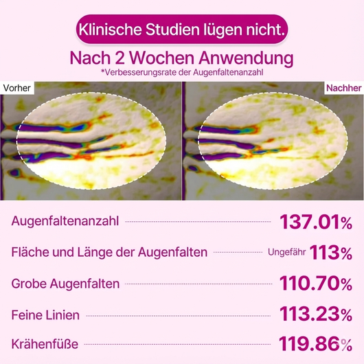 Cemenrete Calcium Volume Augen patch