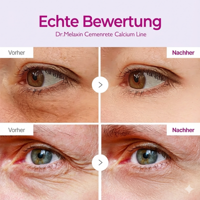Cemenrete Calcium Volume Augen patch