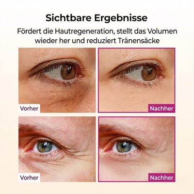 Cemenrete Calcium Volume Augen patch