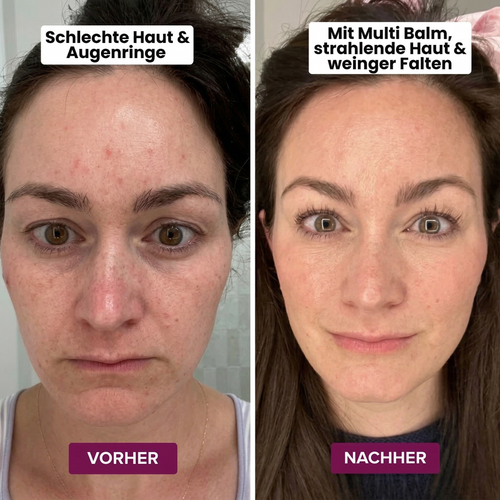 Cemenrete Calcium Multi Balm