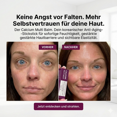 Cemenrete Calcium Multi Balm