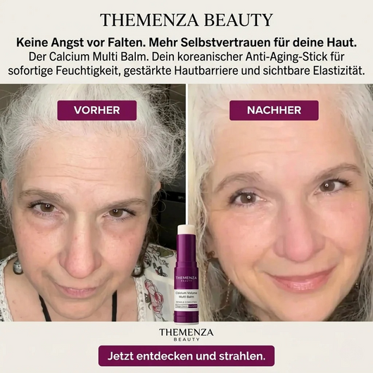 Cemenrete Calcium Multi Balm